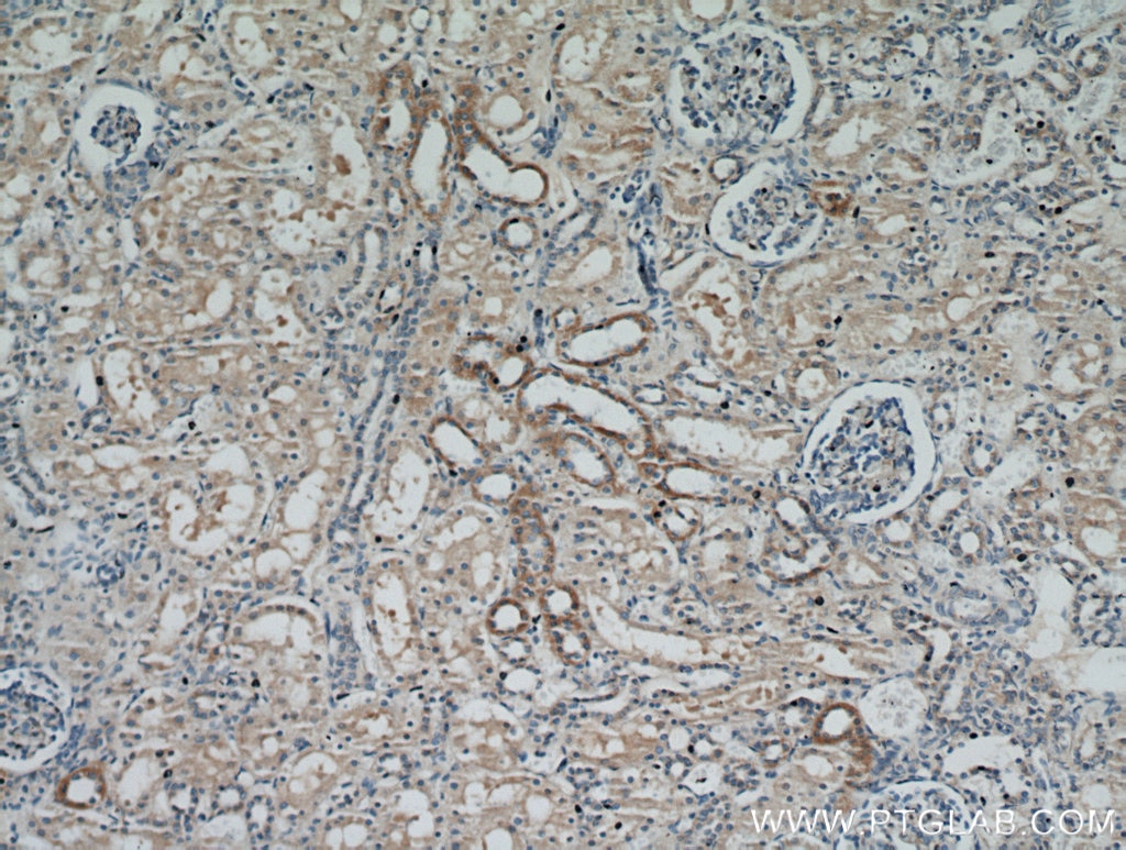 Immunohistochemistry (IHC) staining of human kidney tissue using RBP7 Polyclonal antibody (14541-1-AP)