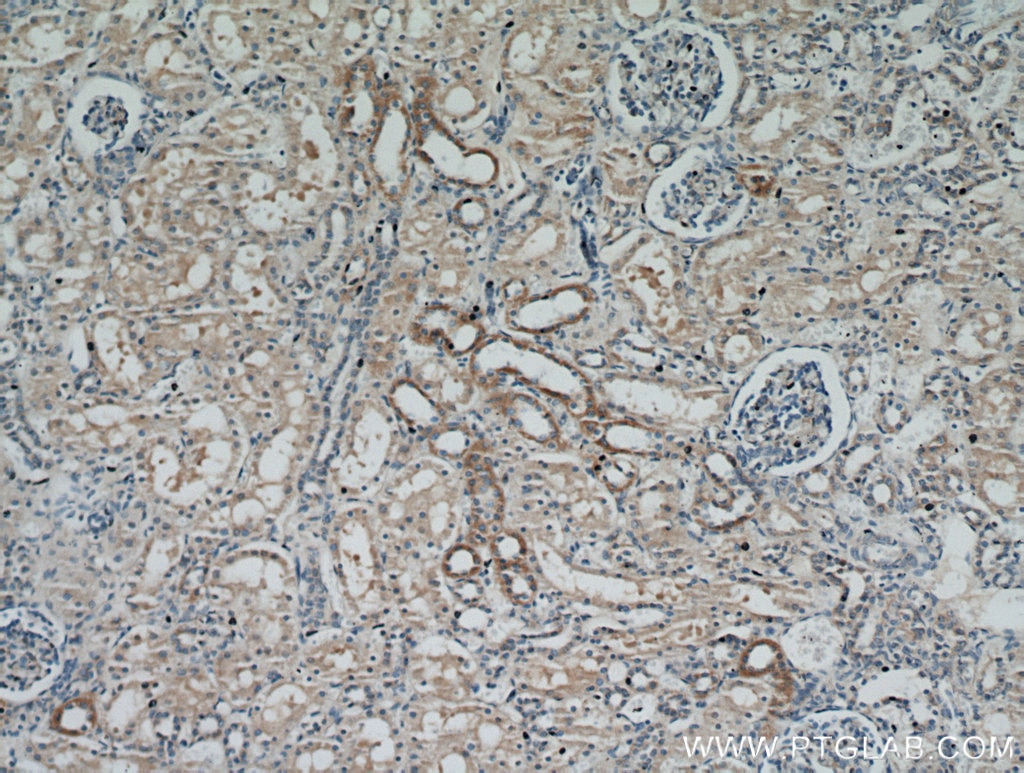 IHC staining of human kidney using 14541-1-AP