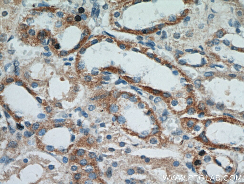 Immunohistochemistry (IHC) staining of human kidney tissue using RBP7 Polyclonal antibody (14541-1-AP)