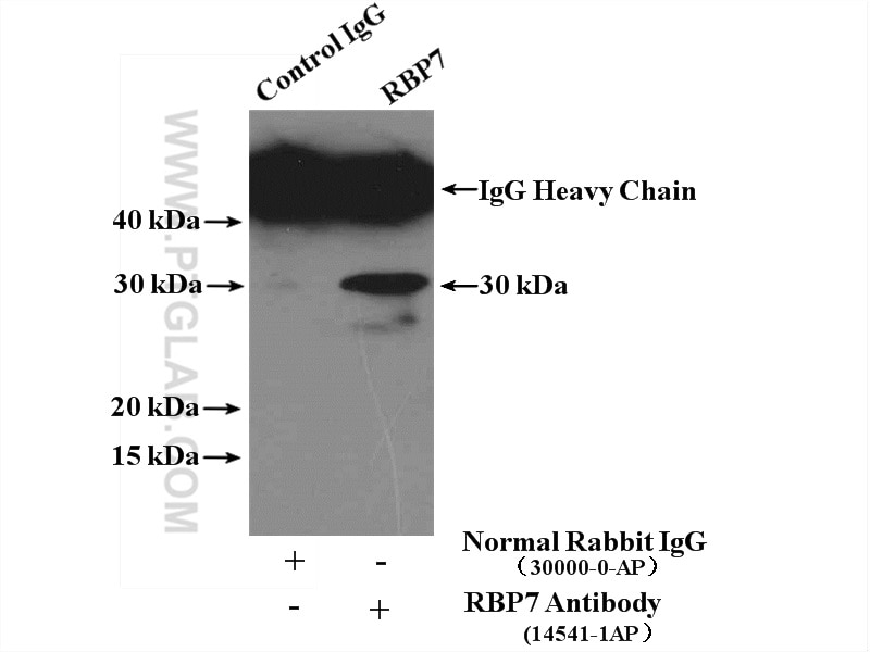 Immunoprecipitation (IP) experiment of HEK-293 cells using RBP7 Polyclonal antibody (14541-1-AP)