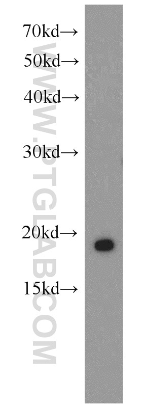 Western Blot (WB) analysis of HEK-293 cells using RBP7 Polyclonal antibody (14541-1-AP)
