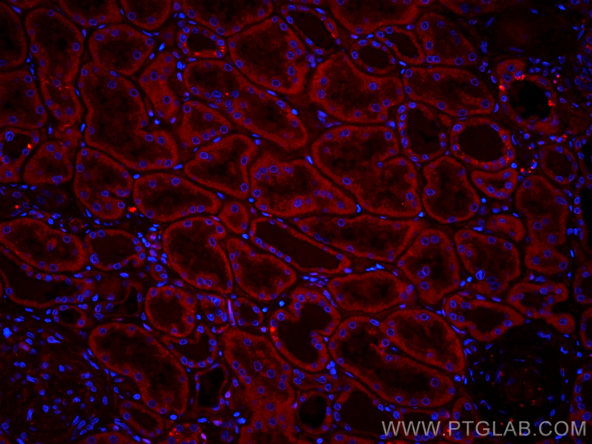 Immunofluorescence (IF) / fluorescent staining of human kidney tissue using CoraLite®594-conjugated RBP7 Polyclonal antibody (CL594-14541)