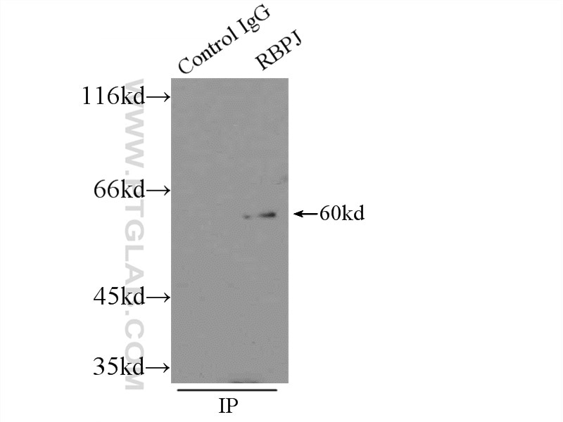 IP experiment of HEK-293 using 14613-1-AP