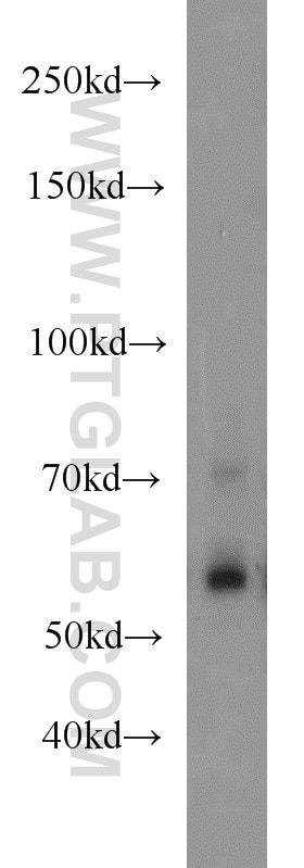 WB analysis of HepG2 using 14613-1-AP