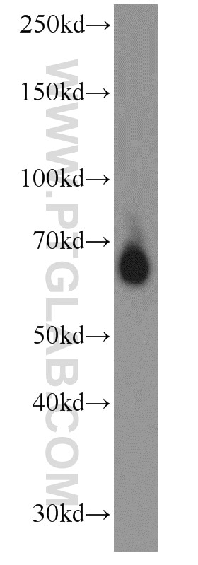 Western Blot (WB) analysis of HeLa cells using RBPJ Polyclonal antibody (14613-1-AP)