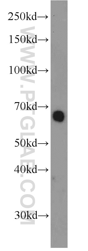 Western Blot (WB) analysis of HEK-293 cells using RBPJ Polyclonal antibody (14613-1-AP)