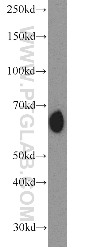 Western Blot (WB) analysis of mouse kidney tissue using RBPJ Polyclonal antibody (14613-1-AP)