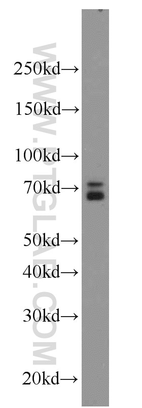 Western Blot (WB) analysis of MCF-7 cells using RBPJ Polyclonal antibody (14613-1-AP)