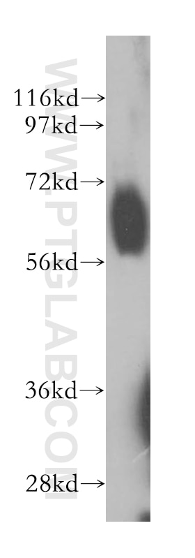 Western Blot (WB) analysis of human liver tissue using RBPJ Polyclonal antibody (14613-1-AP)