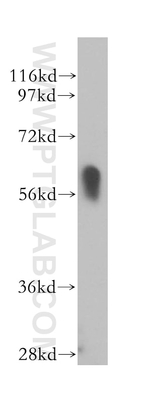 Western Blot (WB) analysis of mouse pancreas tissue using RBPJ Polyclonal antibody (14613-1-AP)