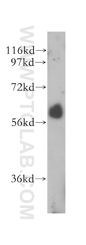 Western Blot (WB) analysis of human heart tissue using RBPJ Polyclonal antibody (14613-1-AP)