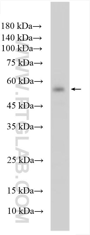 Western Blot (WB) analysis of MCF-7 cells using RBPJ Polyclonal antibody (30044-1-AP)