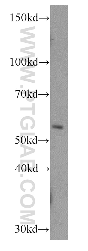 Western Blot (WB) analysis of human brain tissue using RBPJ Monoclonal antibody (66132-1-Ig)