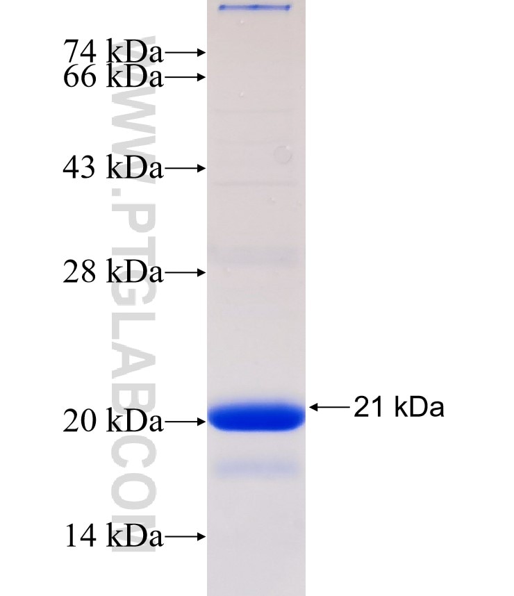RBPJ fusion protein Ag32636 SDS-PAGE RBPJ fusion protein Ag32636 SDS-PAGE