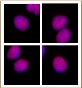 RBPJ antibody (mAb) tested by immunofluorescence. Formaldehyde fixed HeLa cells stained with RBPJ antibody at a 0.5 ug/ml dilution.