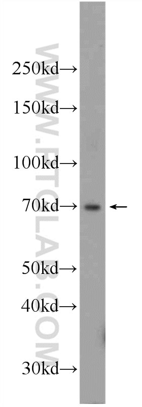 Western Blot (WB) analysis of Raji cells using RBPJL Polyclonal antibody (24664-1-AP)