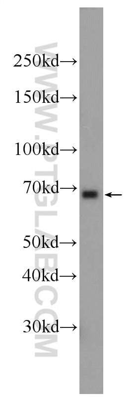 Western Blot (WB) analysis of Jurkat cells using RBPJL Polyclonal antibody (24664-1-AP)
