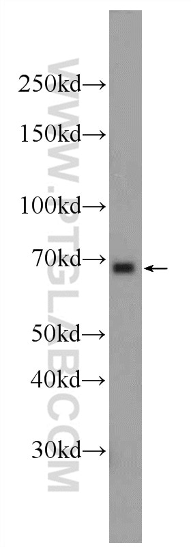 WB analysis of Jurkat using 24664-1-AP