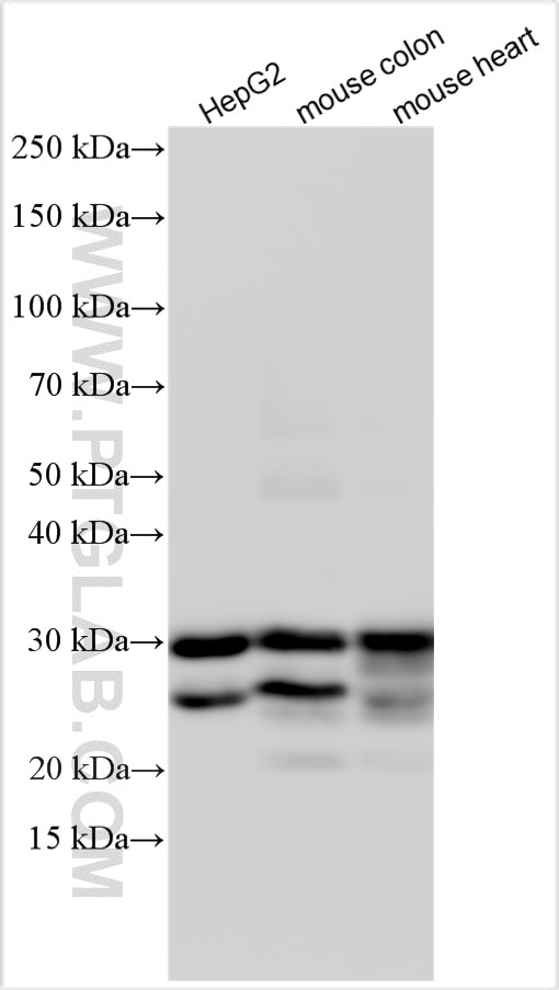 Western Blot (WB) analysis of various lysates using RBPMS Polyclonal antibody (15187-1-AP)