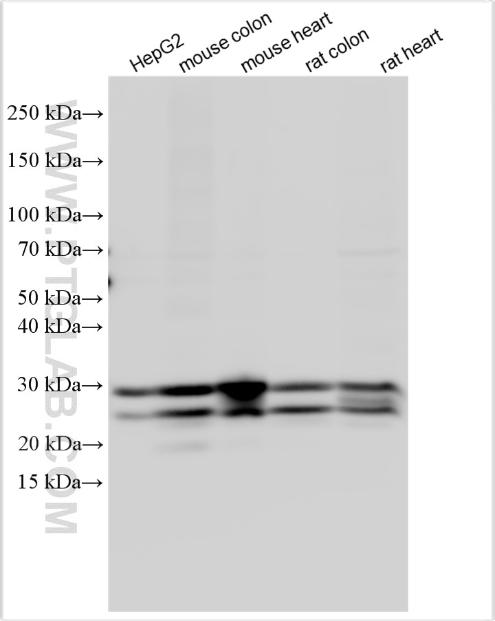 Western Blot (WB) analysis of various lysates using RBPMS Polyclonal antibody (15187-1-AP)