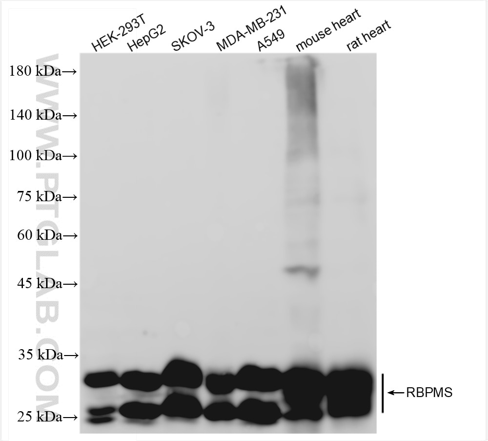 Western Blot (WB) analysis of various lysates using RBPMS Recombinant antibody (85086-5-RR)