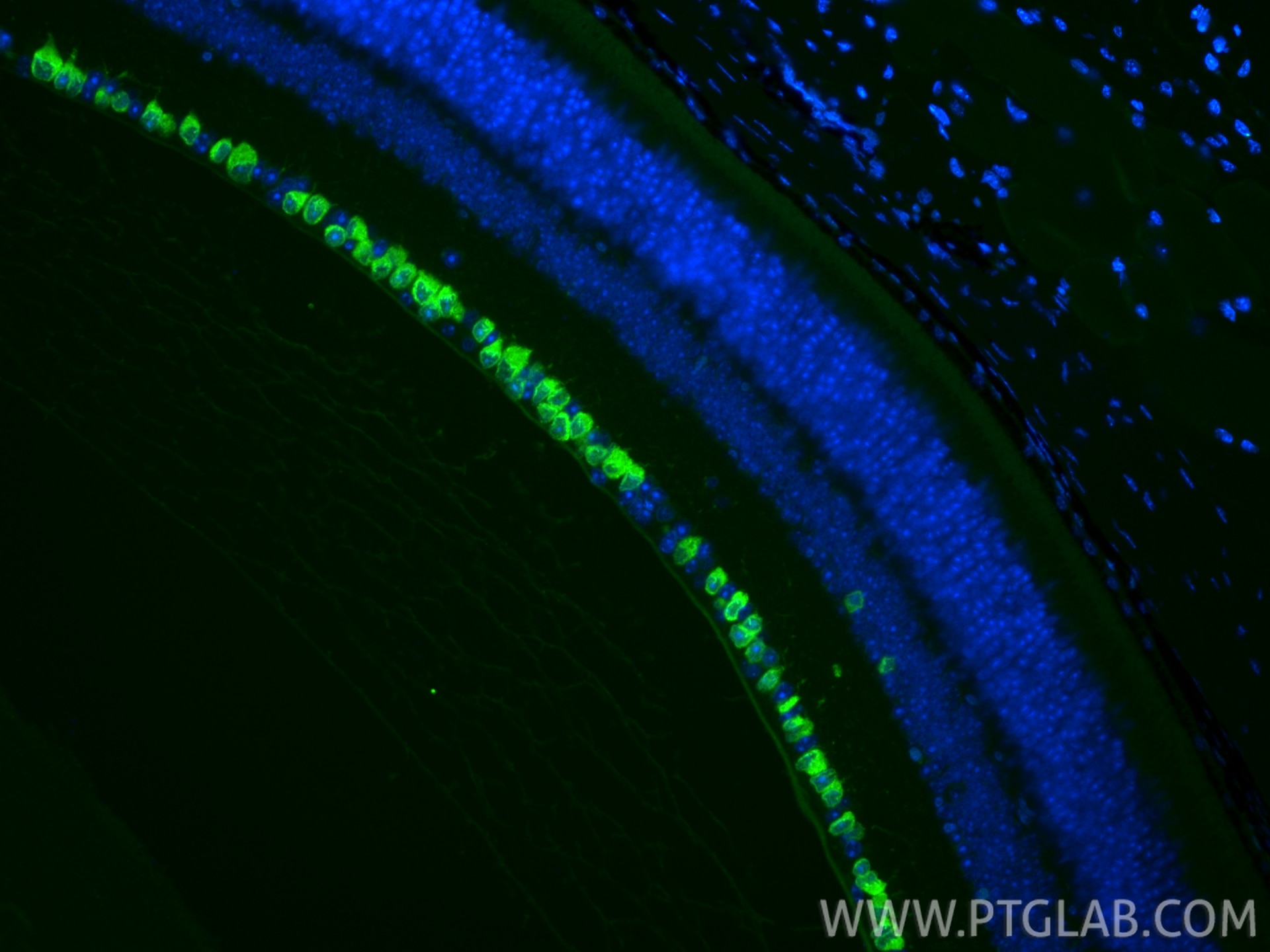 IF Staining of mouse eye using RMX00116 Immunofluorescence (IF) / fluorescent staining of mouse eye tissue using Multi-rAb® RBPMS Multi-Recombinant antibody (RMX00116)