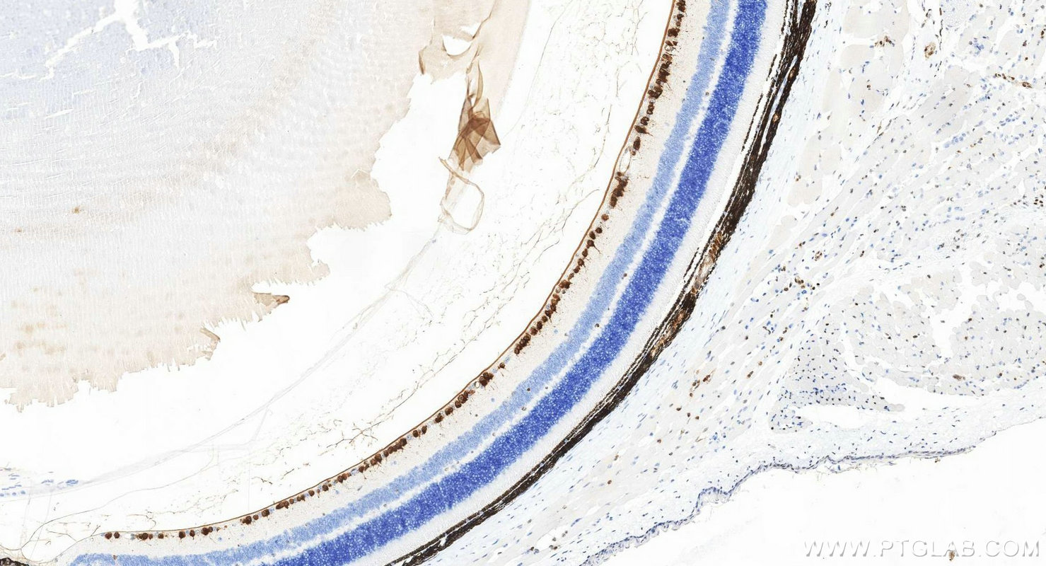 IHC staining of mouse eye using RMX00116 Immunohistochemistry (IHC) staining of mouse eye tissue using Multi-rAb® RBPMS Multi-Recombinant antibody (RMX00116)