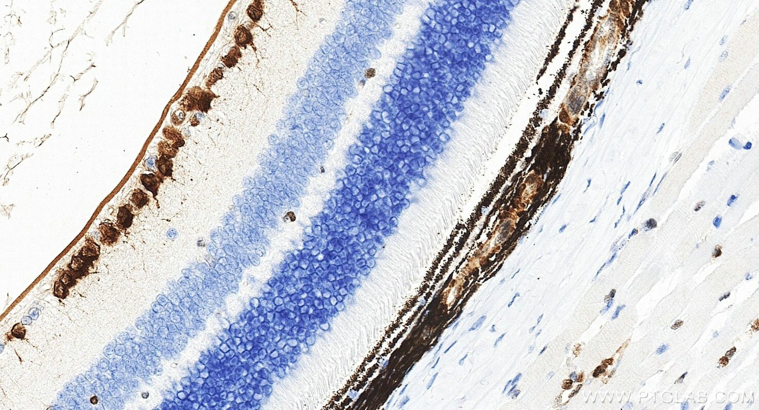 IHC staining of mouse eye using RMX00116 Immunohistochemistry (IHC) staining of mouse eye tissue using Multi-rAb® RBPMS Multi-Recombinant antibody (RMX00116)