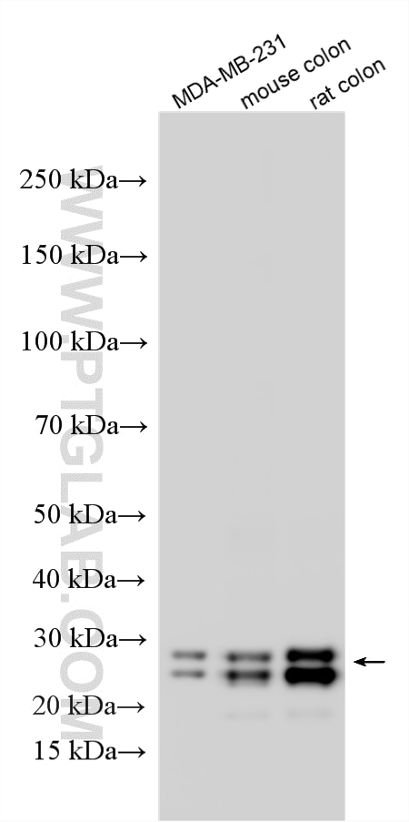 WB analysis using RMX00116 Western Blot (WB) analysis of various lysates using Multi-rAb® RBPMS Multi-Recombinant antibody (RMX00116)