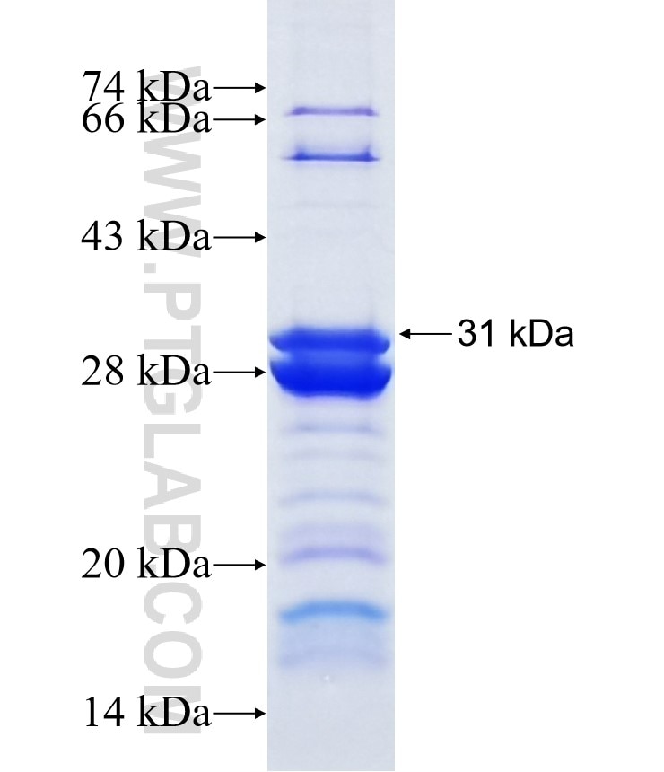 RBPMS fusion protein Ag7959 SDS-PAGE
