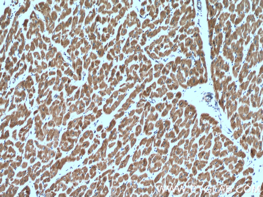 IHC staining of human heart using 14895-1-AP