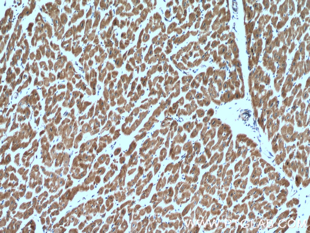 Immunohistochemistry (IHC) staining of human heart tissue using RBX1 Polyclonal antibody (14895-1-AP)