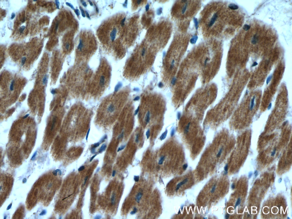 Immunohistochemistry (IHC) staining of human heart tissue using RBX1 Polyclonal antibody (14895-1-AP)