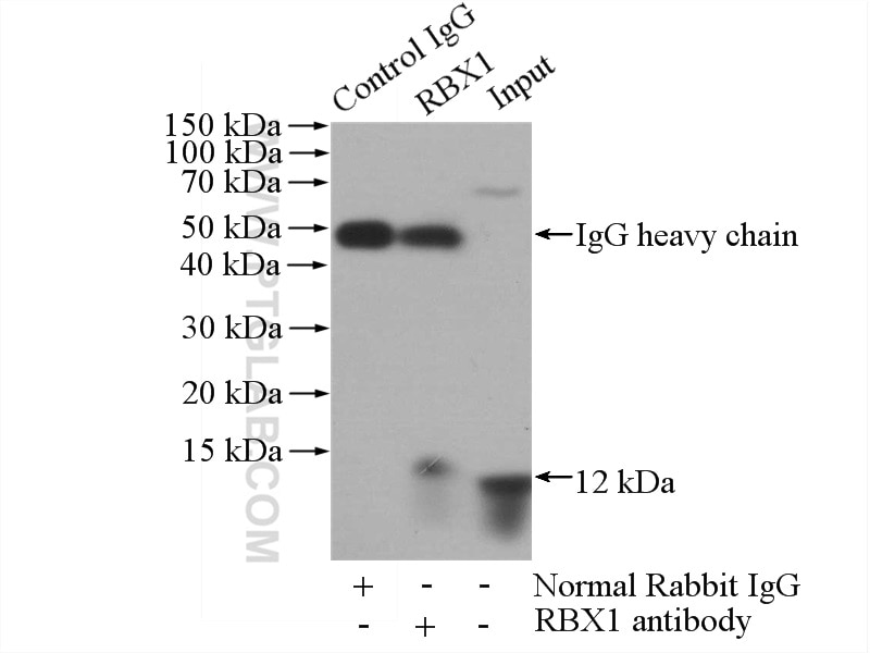 Immunoprecipitation (IP) experiment of HeLa cells using RBX1 Polyclonal antibody (14895-1-AP)