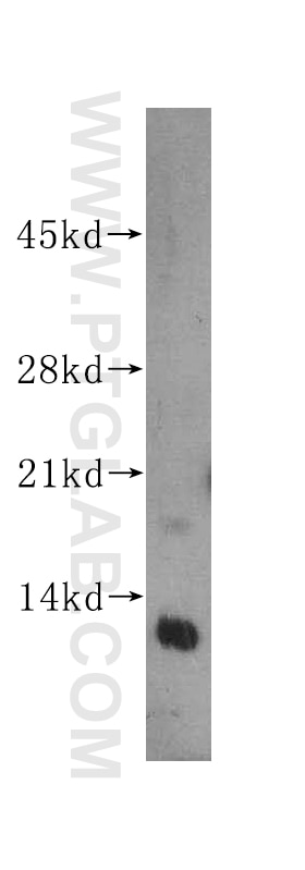 RBX1 Polyclonal antibody