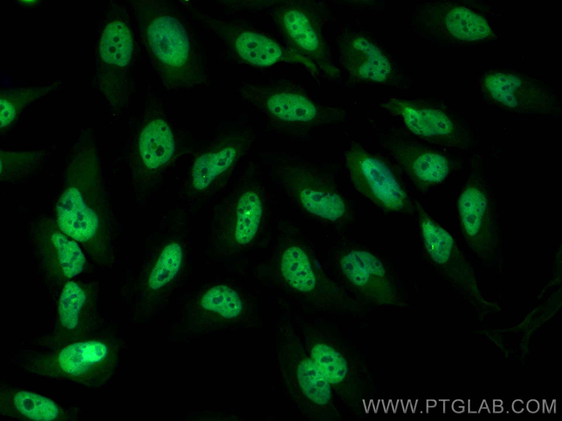 Immunofluorescence (IF) / fluorescent staining of HeLa cells using CoraLite® Plus 488-conjugated RBX1 Monoclonal anti (CL488-66716)