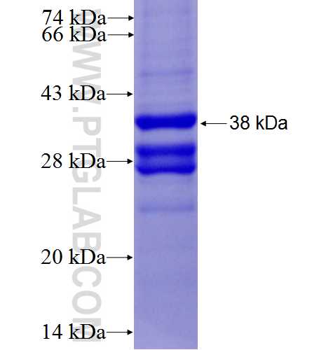 RBX1 fusion protein Ag6685 SDS-PAGE