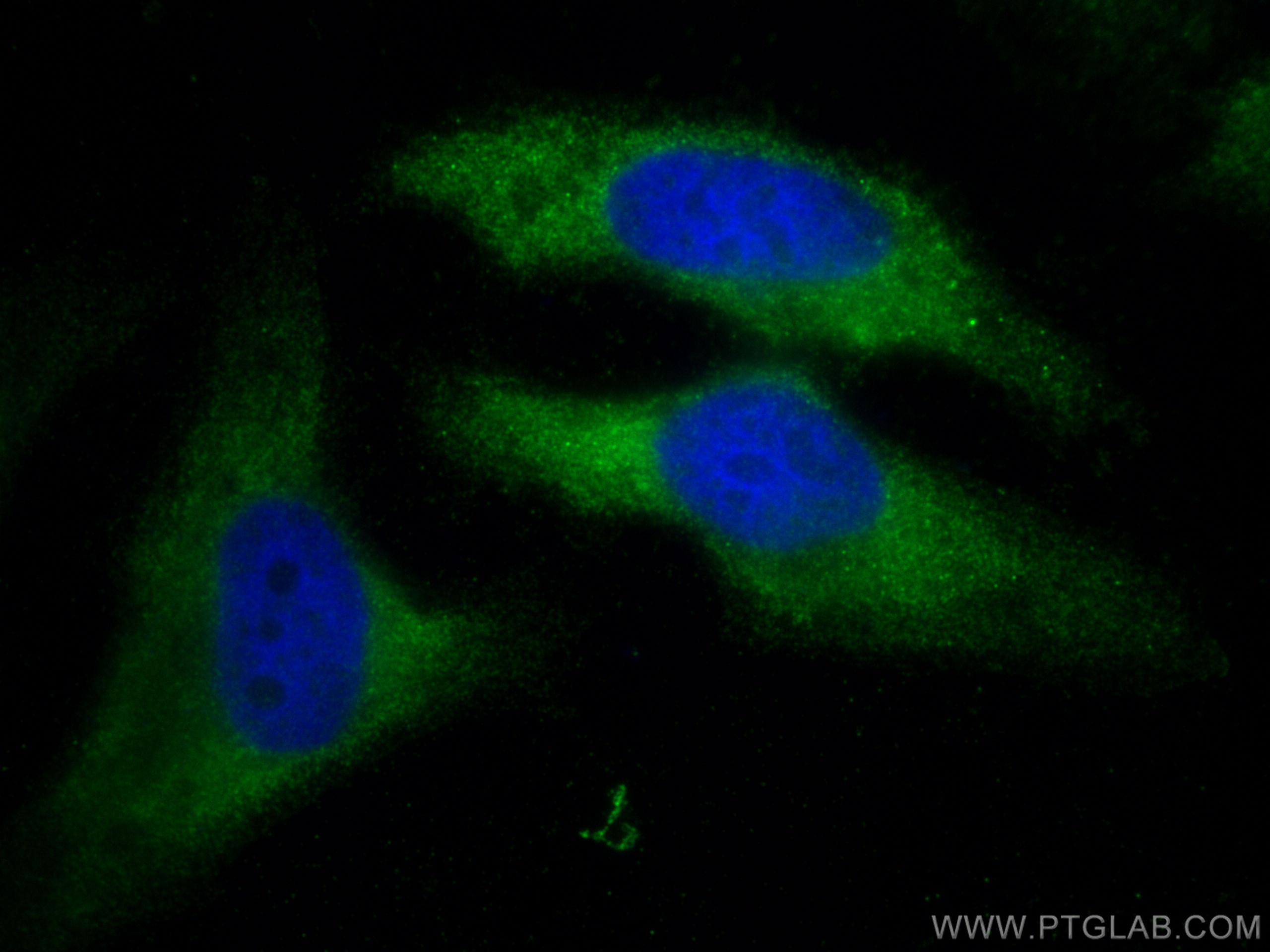 Immunofluorescence (IF) / fluorescent staining of HeLa cells using RC3H1 Polyclonal antibody (31234-1-AP)