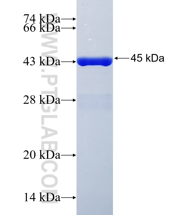 RC3H1 fusion protein Ag35089 SDS-PAGE