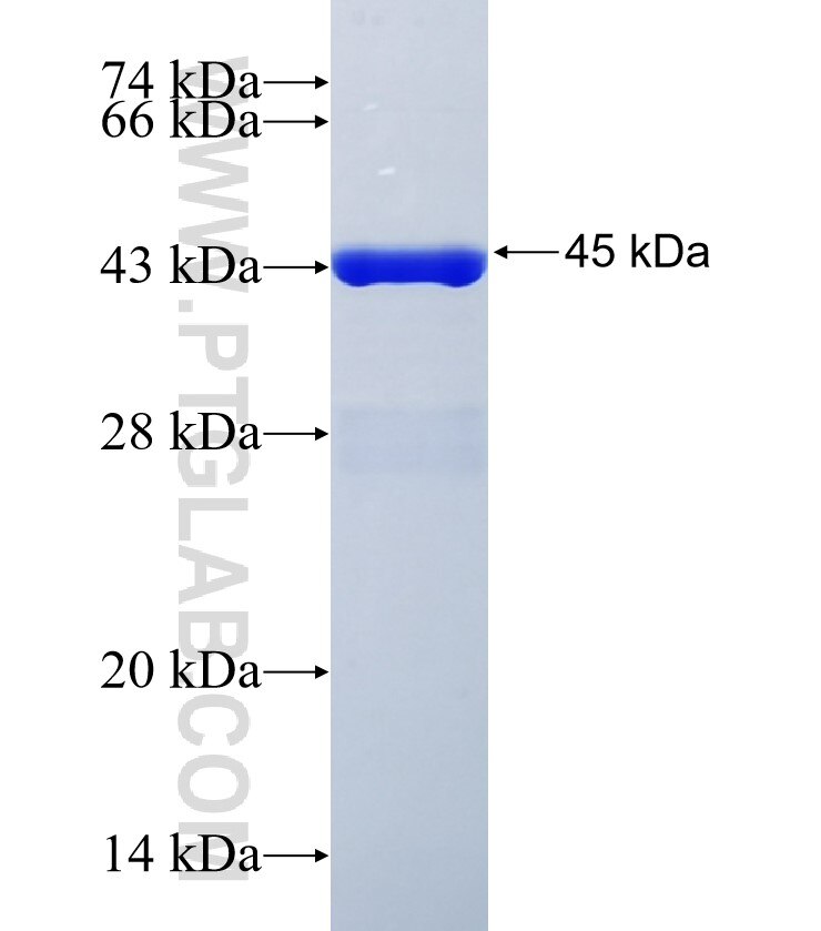 RC3H1 fusion protein Ag35089 SDS-PAGE