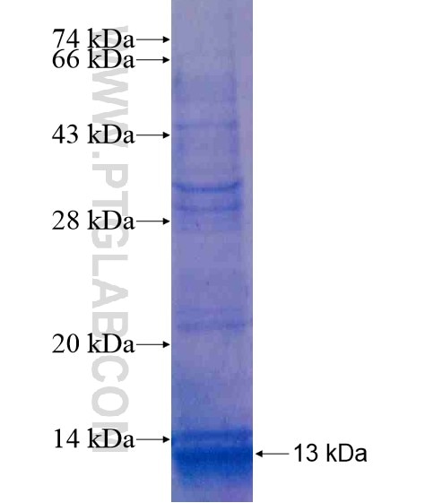 RC3H2 fusion protein Ag20408 SDS-PAGE