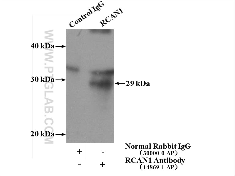 Immunoprecipitation (IP) experiment of mouse brain tissue using Calcipressin 1 Polyclonal antibody (14869-1-AP)