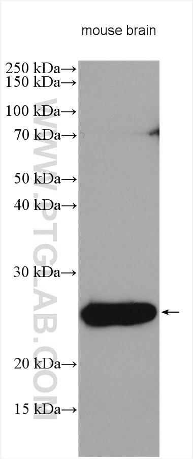 Western Blot (WB) analysis of various lysates using Calcipressin 1 Polyclonal antibody (14869-1-AP)