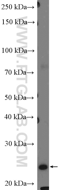Western Blot (WB) analysis of SKOV-3 cells using Calcipressin 1 Polyclonal antibody (14869-1-AP)
