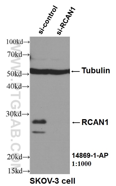 Western Blot (WB) analysis of SKOV-3 cells using Calcipressin 1 Polyclonal antibody (14869-1-AP)