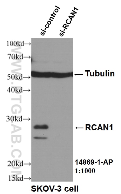 WB analysis of SKOV-3 cells using 14869-1-AP