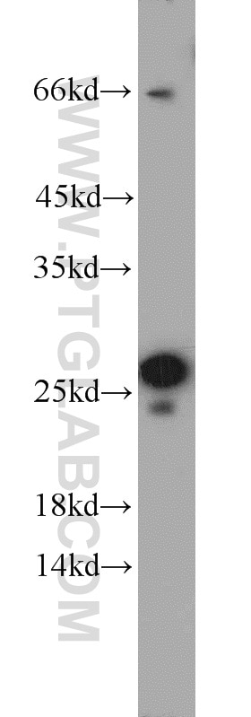 Western Blot (WB) analysis of mouse skeletal muscle tissue using Calcipressin 1 Polyclonal antibody (14869-1-AP)