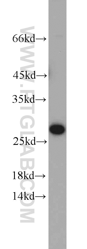 Western Blot (WB) analysis of mouse heart tissue using Calcipressin 1 Polyclonal antibody (14869-1-AP)