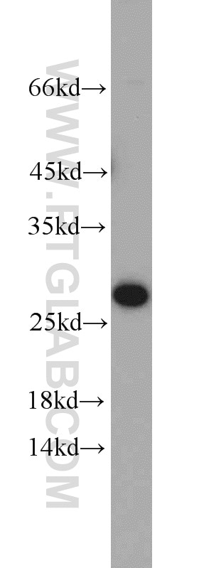 WB analysis of mouse heart using 14869-1-AP