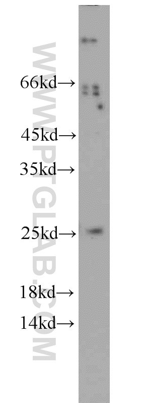Western Blot (WB) analysis of A431 cells using Calcipressin 1 Polyclonal antibody (14869-1-AP)